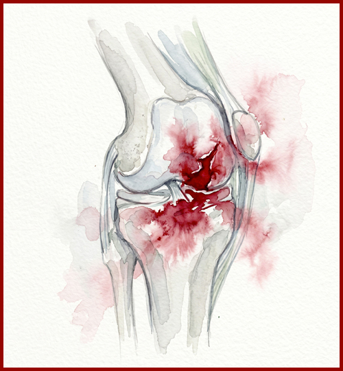 Illustration.