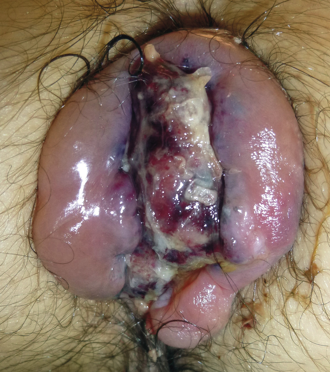 a