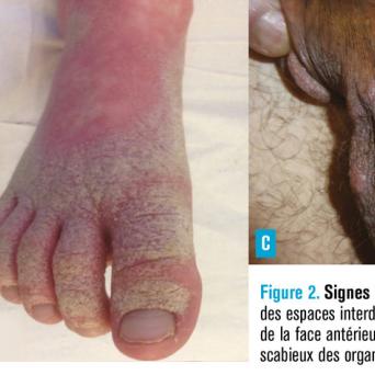 signes