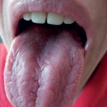 y