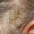 v