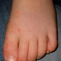 main pied bouche