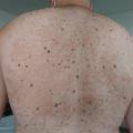 v