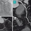 scanner cardiaque