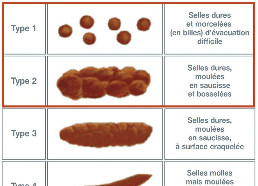 FIGURE 1 Échelle de Bristol (types 1 et 2 retrouvés le plus fréquemment). La Revue du Praticien